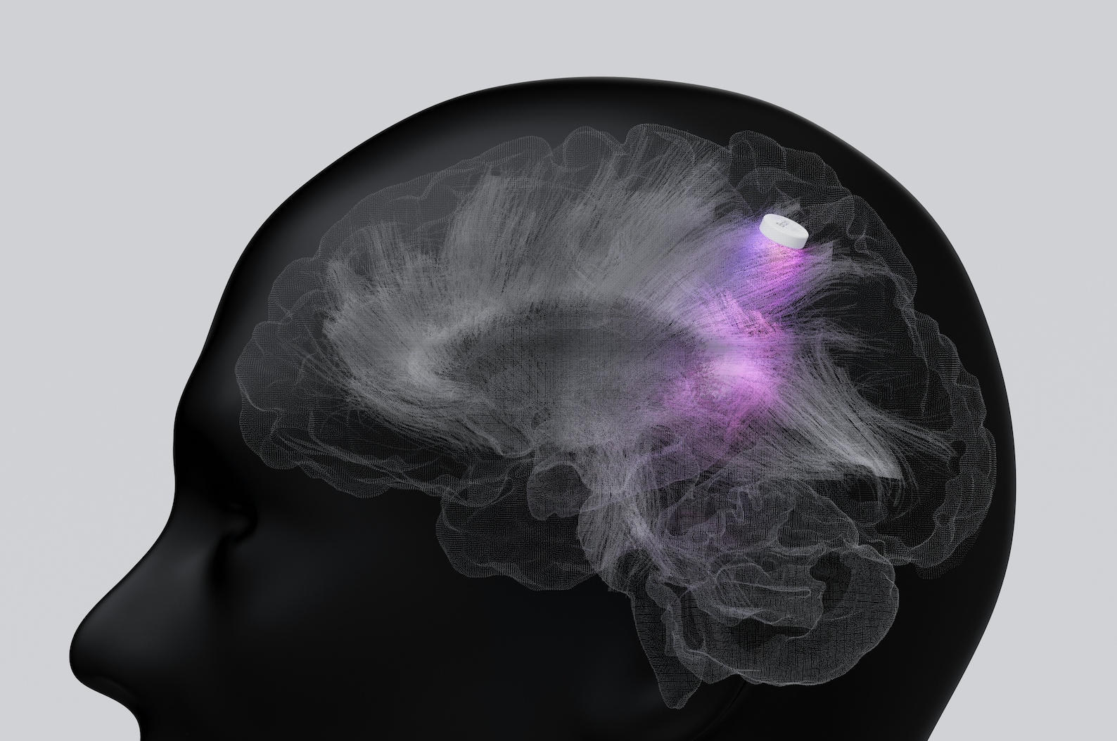 Why Clients Panic, Freeze, or Self-Sabotage—and How Neuroscience Helps Advisors Respond